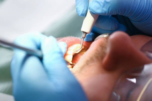 Best Holiday Emergency Dentist in Salem, NC