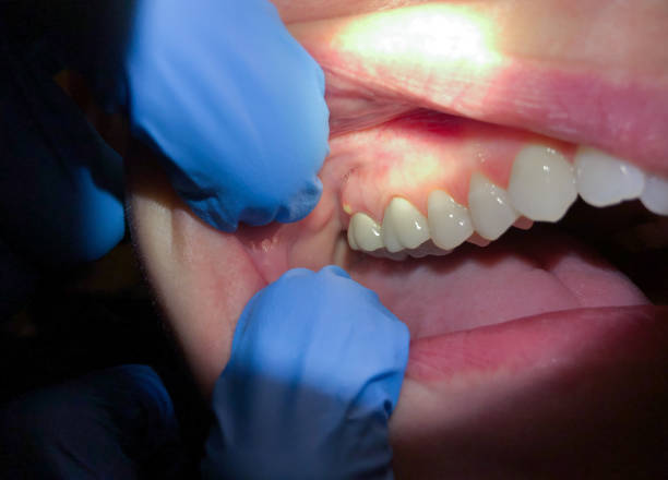 Best Emergency Cosmetic Dentistry in Salem, NC